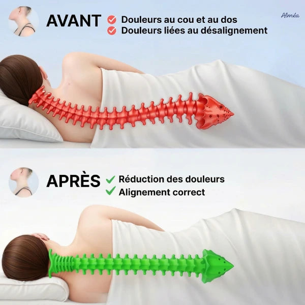 Alméa Align™ – Soulagement cervical